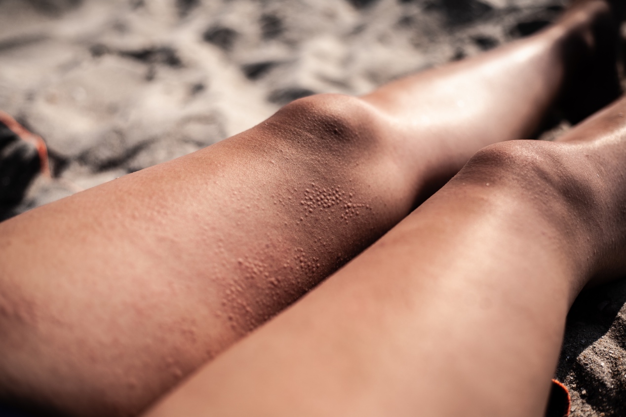 ženské nohy, fotka z pláže