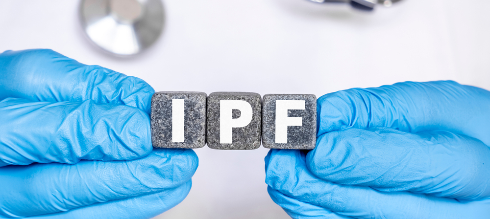 IPF idiopatická pľúcna fibróza – slovo utvorené z písmenok na kockách kameňa, ktoré drží lekár v ruke